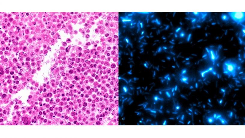 Histology image of bacteria growing within necrotic regions of lymphoma tumors (LEFT). Bacteria are programmed to undergo waves of growth and self-destruction leading to immunotherapeutic release (RIGHT). Histology image of bacteria growing within necrotic regions of lymphoma tumors (LEFT). Bacteria are programmed to undergo waves of growth and self-destruction leading to immunotherapeutic release (RIGHT).