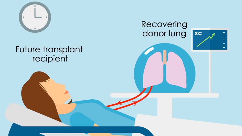 Reviving Lungs